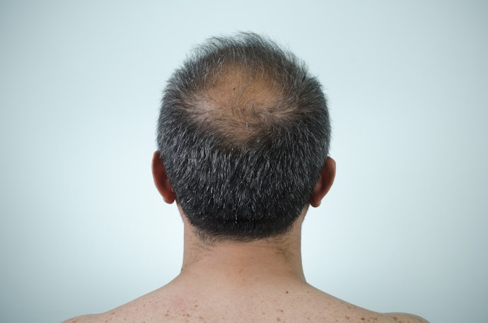 Como Evitar Queda de Cabelo?