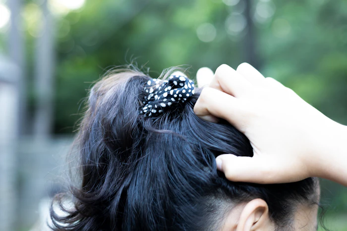 Caspa: O que é, Causas, Como Tratar e mais