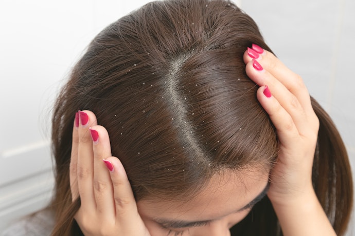 Afinal, Quem tem Caspa Pode Usar Shampoo de Coco?