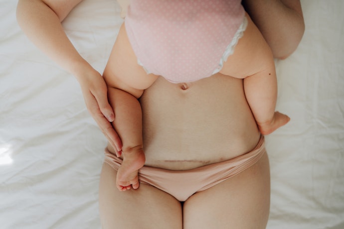 Por Que Usar Calcinha Pós-Parto?