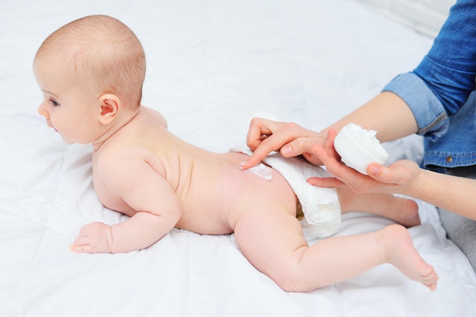 Qual é a Melhor Pomada para Prevenir Assaduras? E para Tratá-las?