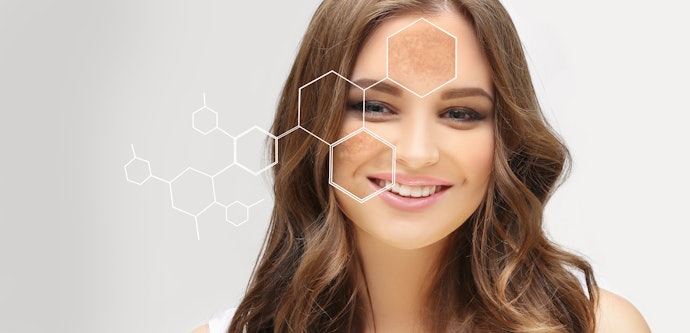 O Que É Melasma?