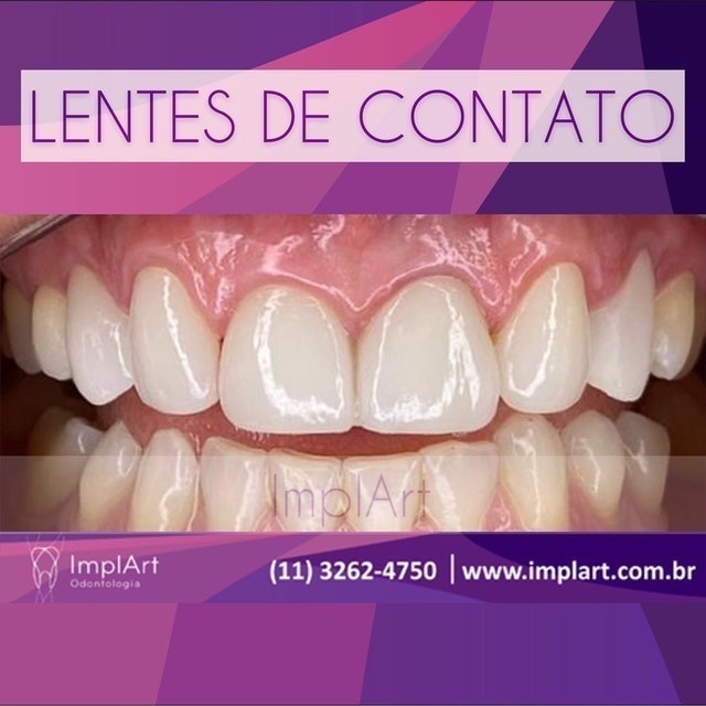 ImplArt Odontologia 4