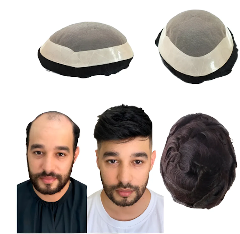 Prótese Capilar Masculina Híbrida Respirável Cabelo Humano 1