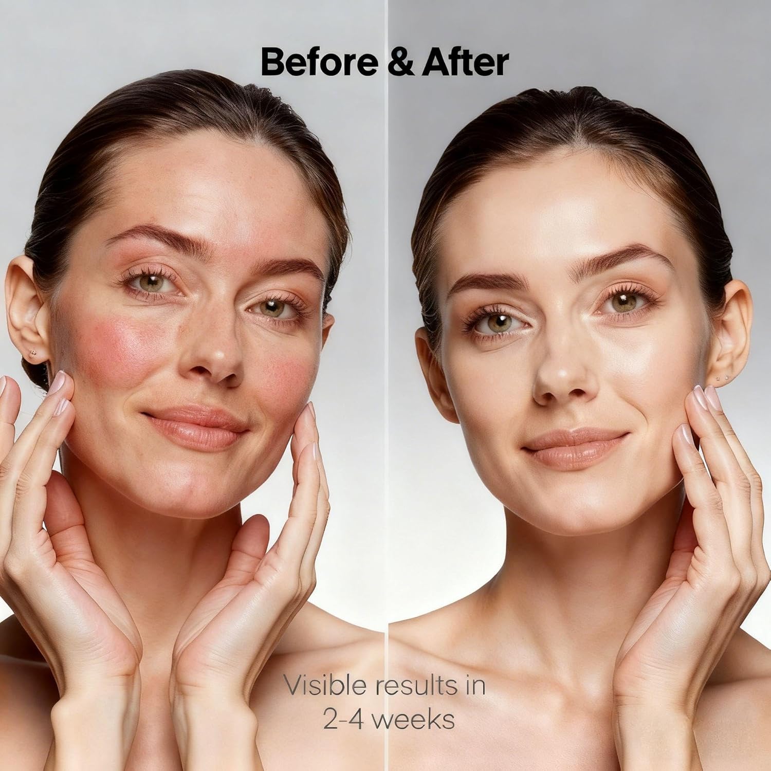 Máquina Facial Diamond Glow 3