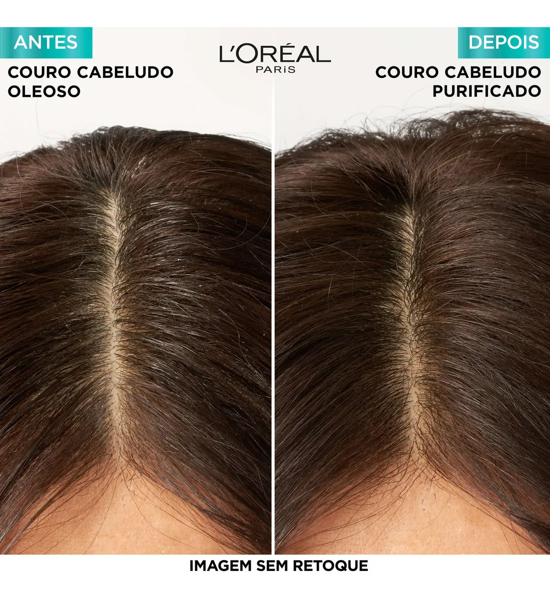 Pure Hialurônico Shampoo Hidra Purificante 5