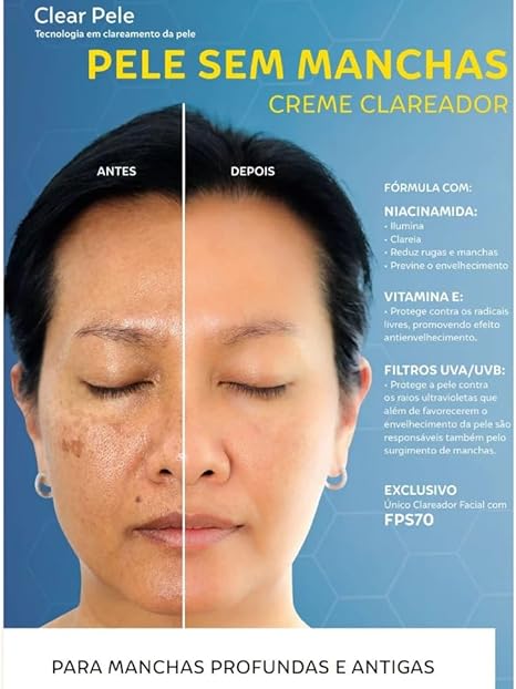 Clear Pele Creme Clareador 5
