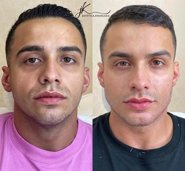 JK Estética Avançada 5