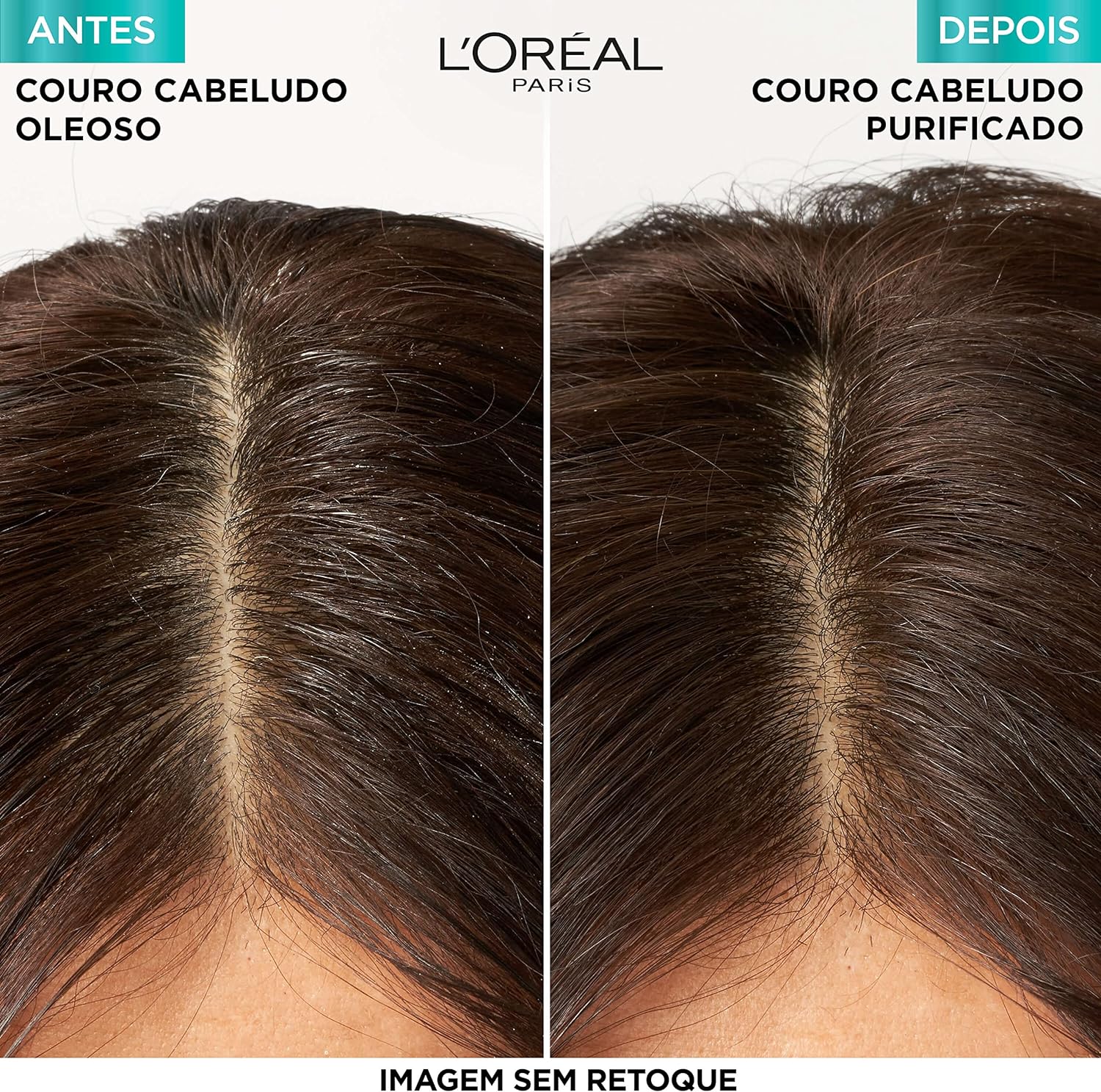 Pure Hialurônico Shampoo Hidra Purificante 2