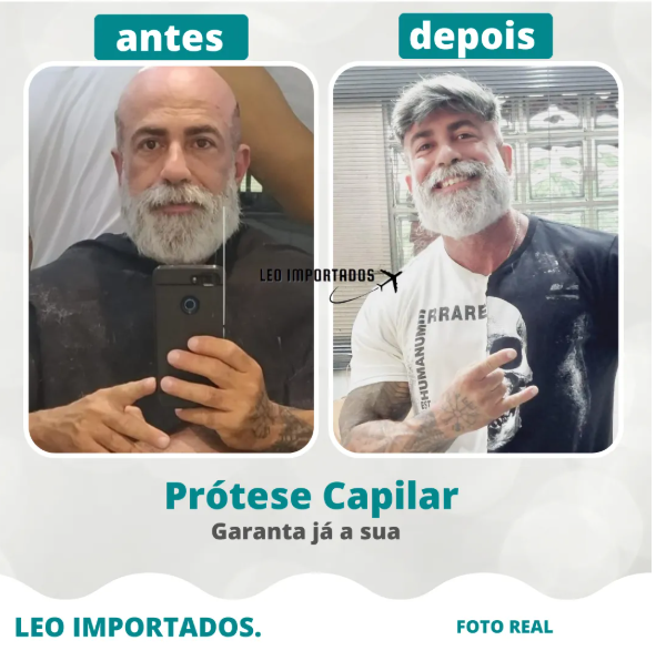 Prótese Capilar Micropele Masculina Várias Cores Nó Duplo 3