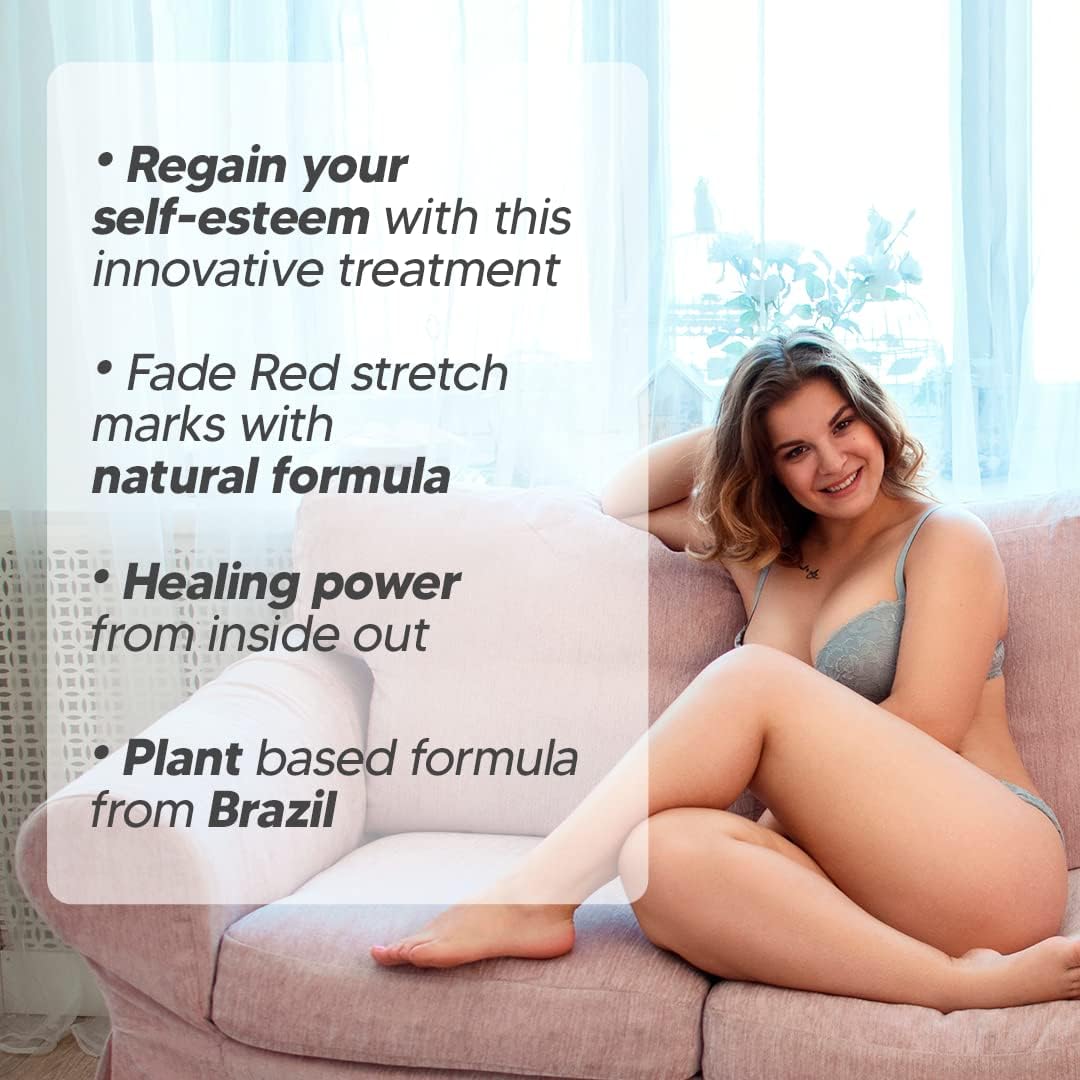 CicatriSSim Red - Específico para Estrias Vermelhas 3