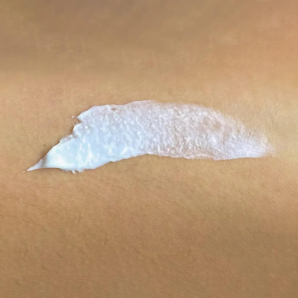 Creme Antiestrias Regenerador Dérmico 3