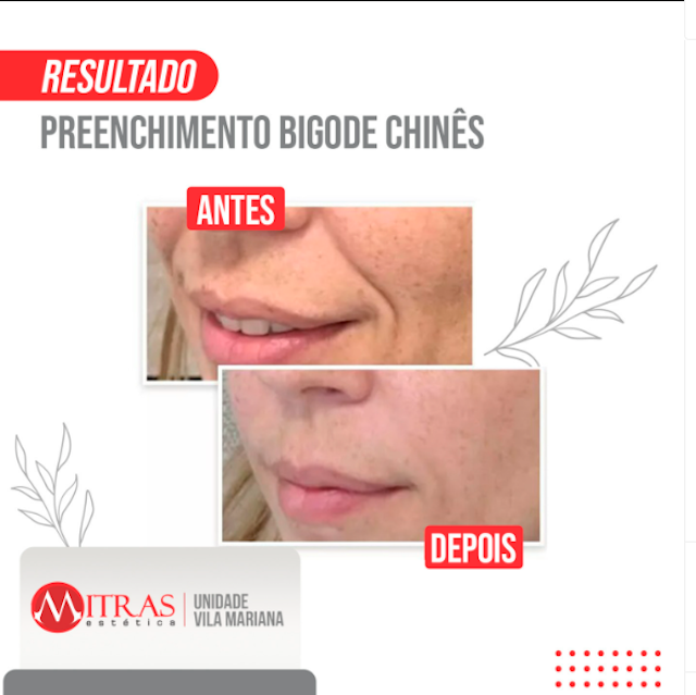 Mitras Estética 4