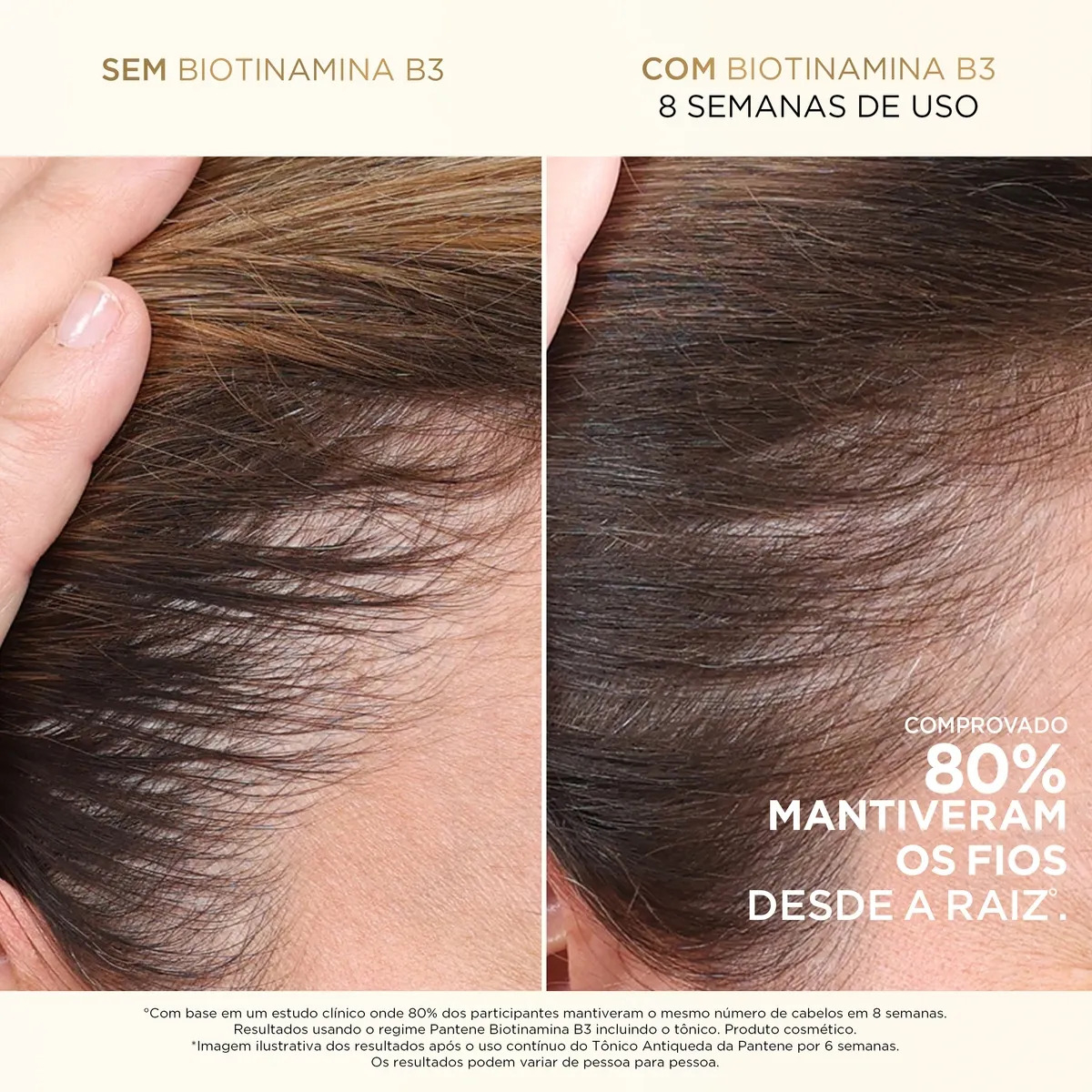 Shampoo Antiqueda Biotinamina B3 3