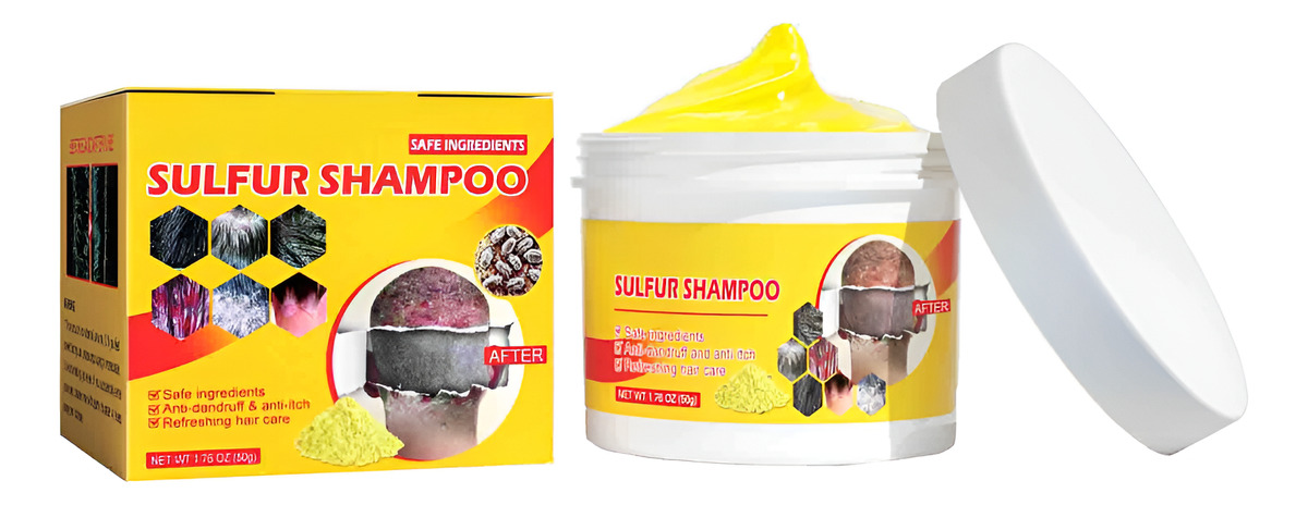 Shampoo de Enxofre para Piolhos 1