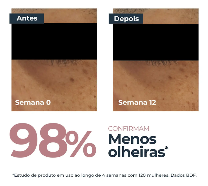 Anti-Pigment Creme Clareador de Olheiras 4