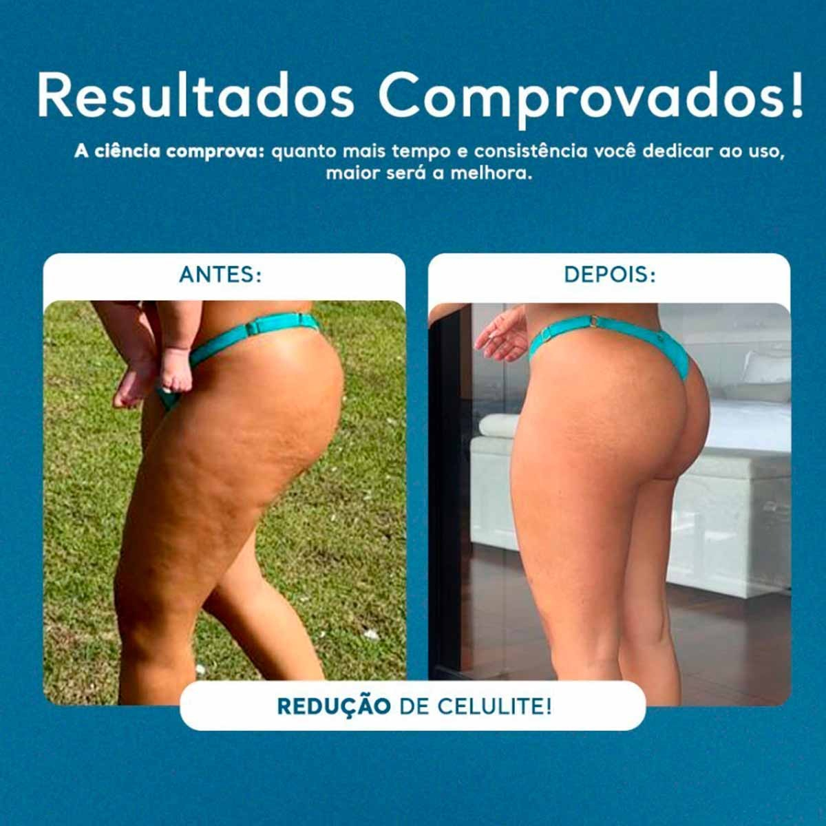 Gel Redutor de Medidas, Celulites e Flacidez 5