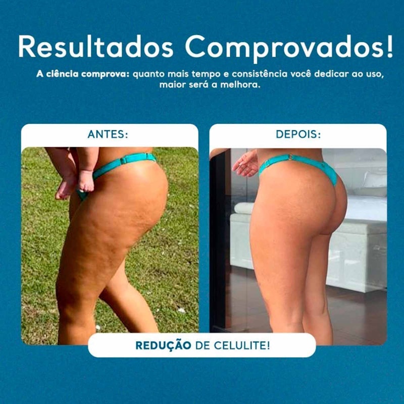 Gel Redutor de Medidas, Celulites e Flacidez 5