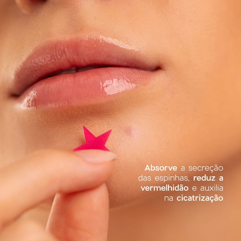 Adesivos Secativos para Espinhas com Ácido Salicílico Star Acne Patches 4you 5