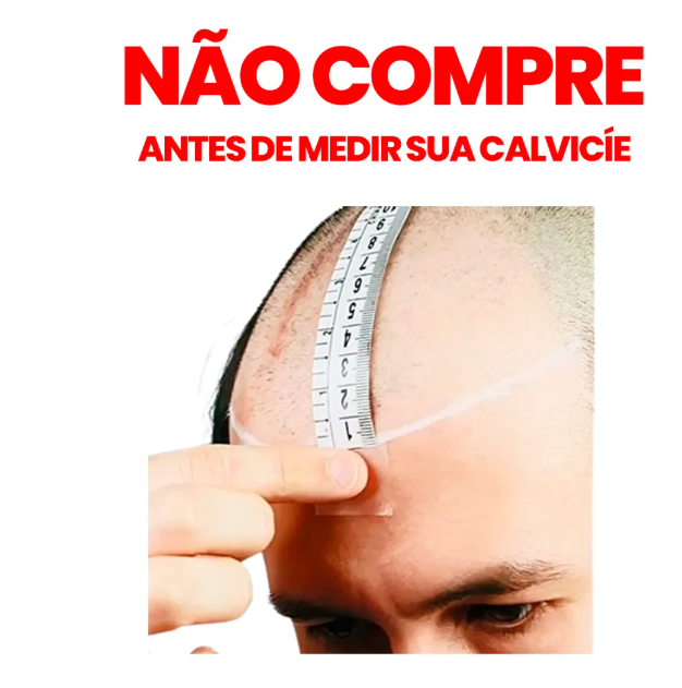Prótese Capilar Masculina Híbrida Respirável Cabelo Humano 2