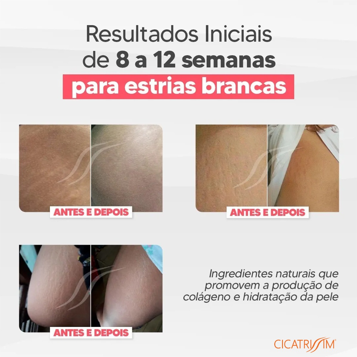 Cicatrissim White 3