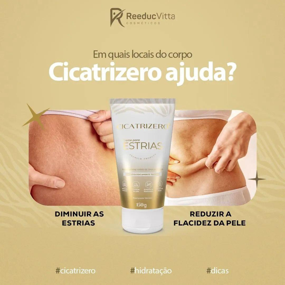 Cicatrizero Creme para Estrias 2