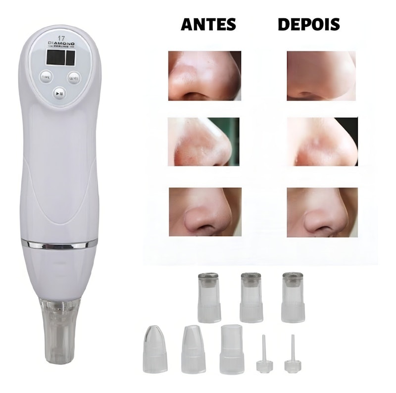 Removedor de Cravo e Acne Diamond Peeling 8
