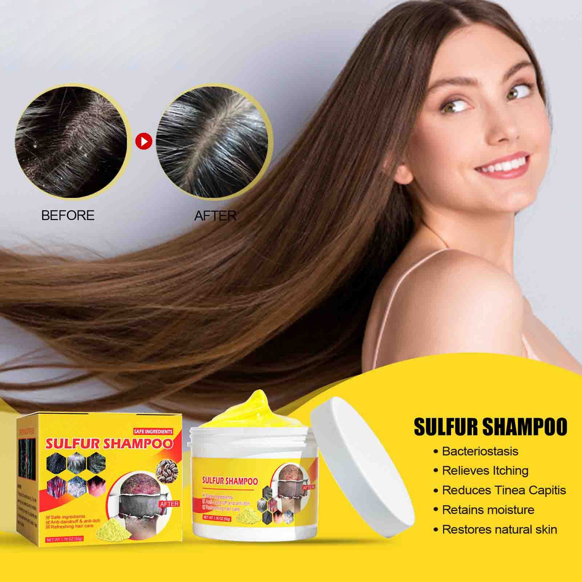 Shampoo de Enxofre para Piolhos 2