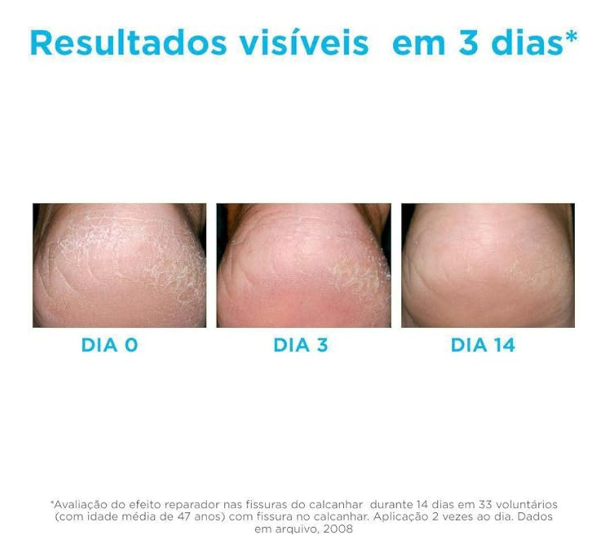 Ureadin Podos Gel Óleo Pés Secos e Ásperos 2