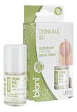 Top 10 Melhores Esmaltes Antifúngicos em 2026 (Dailus, Ideal e mais) 3
