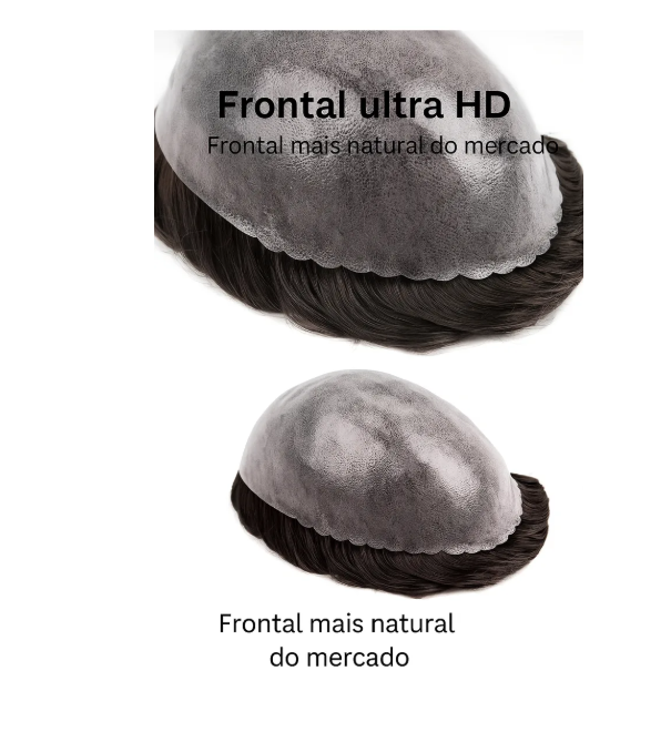 Prótese Capilar Fios Implantados em Nó Duplo Todas As Cores 3