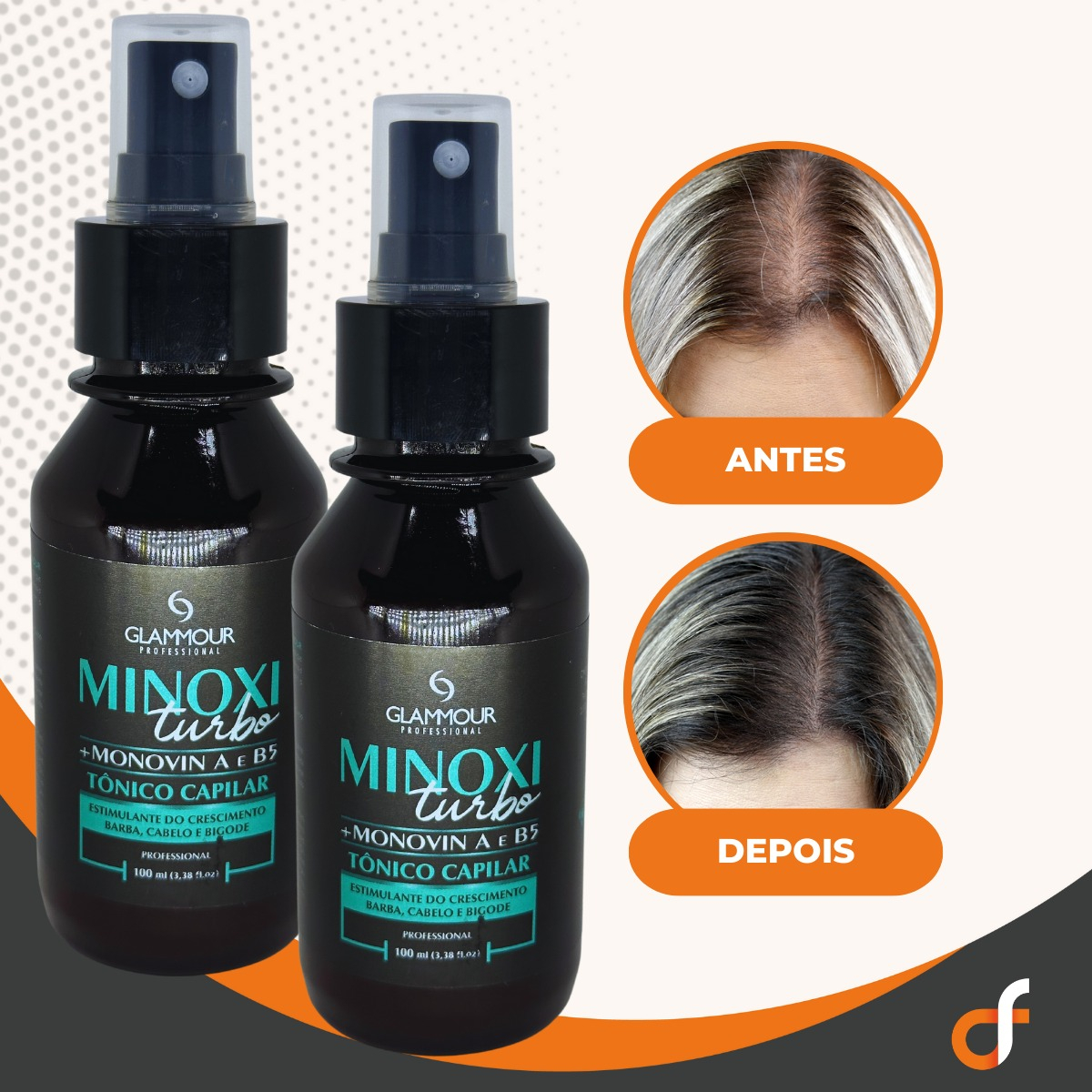 Tônico Capilar Minoxi Turbo Glammour Professional 4