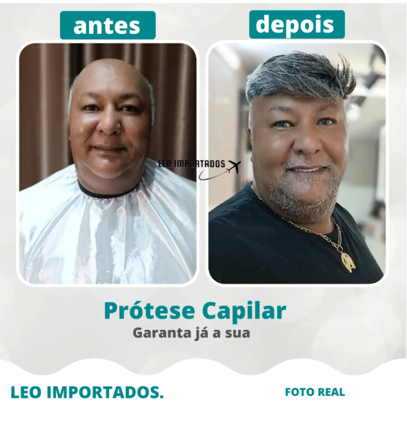 Prótese Capilar Micropele Masculina Várias Cores Nó Duplo 4