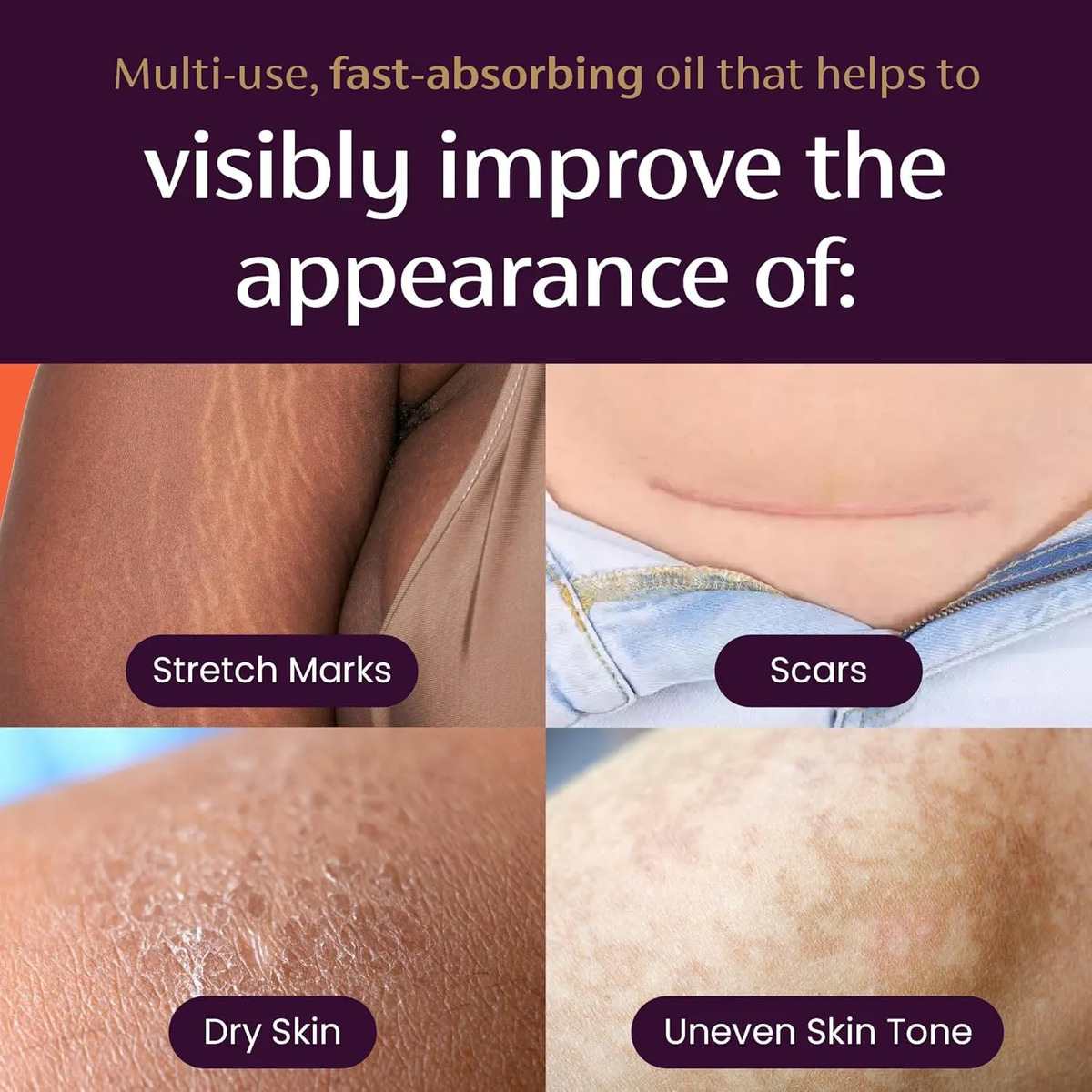 Mederma Quick Dry Oil 4