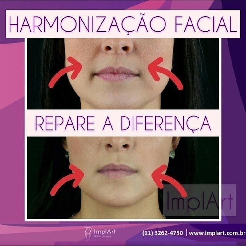 ImplArt Odontologia 5