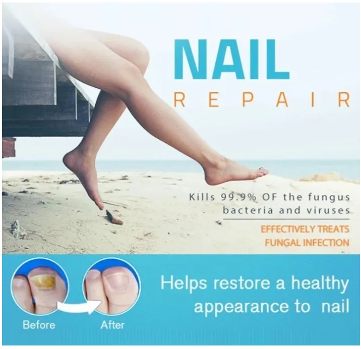 Nail Cure Esmalte Caneta Fungicida Lanthome Repara Unhas 3