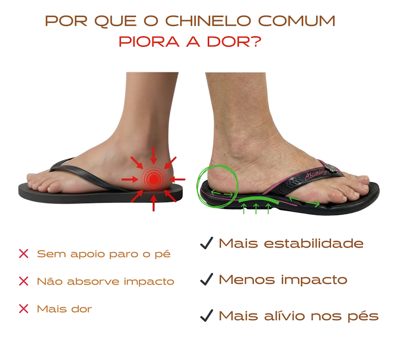 Chinelo Feminino Ortopédico Anatômico 3