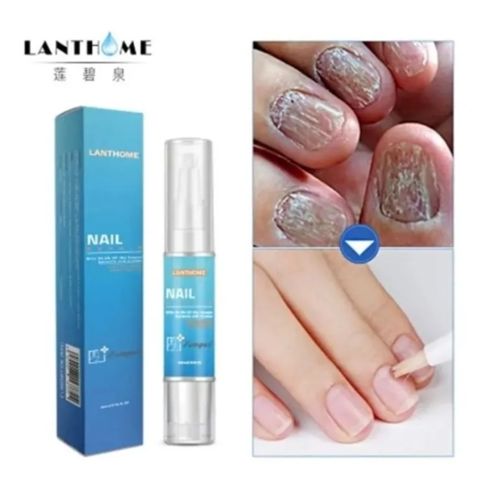 Nail Cure Esmalte Caneta Fungicida Lanthome Repara Unhas 2
