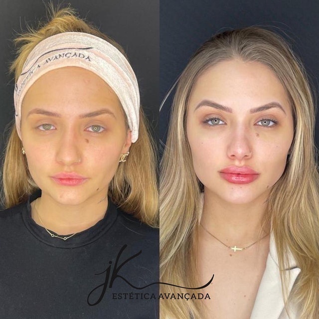 JK Estética Avançada 4