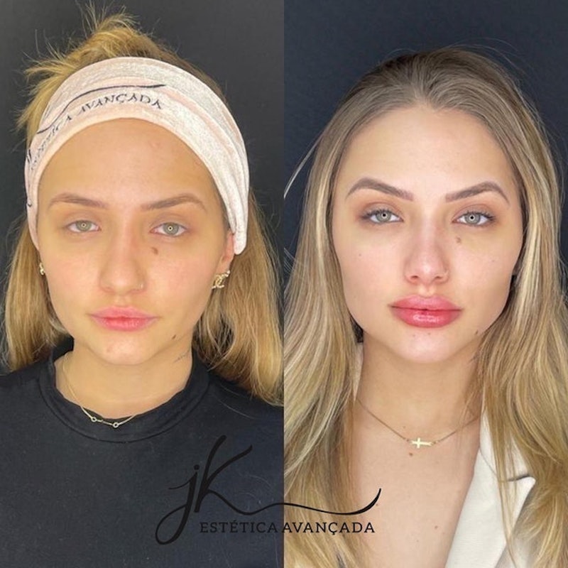 JK Estética Avançada 4