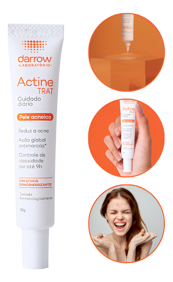 Top 10 Melhores Pomadas para Acne  (Cimed, Payot e mais) 5