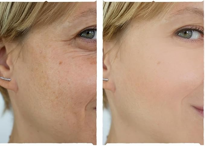 Niacinamida 25% Sérum Facial Clareador 4