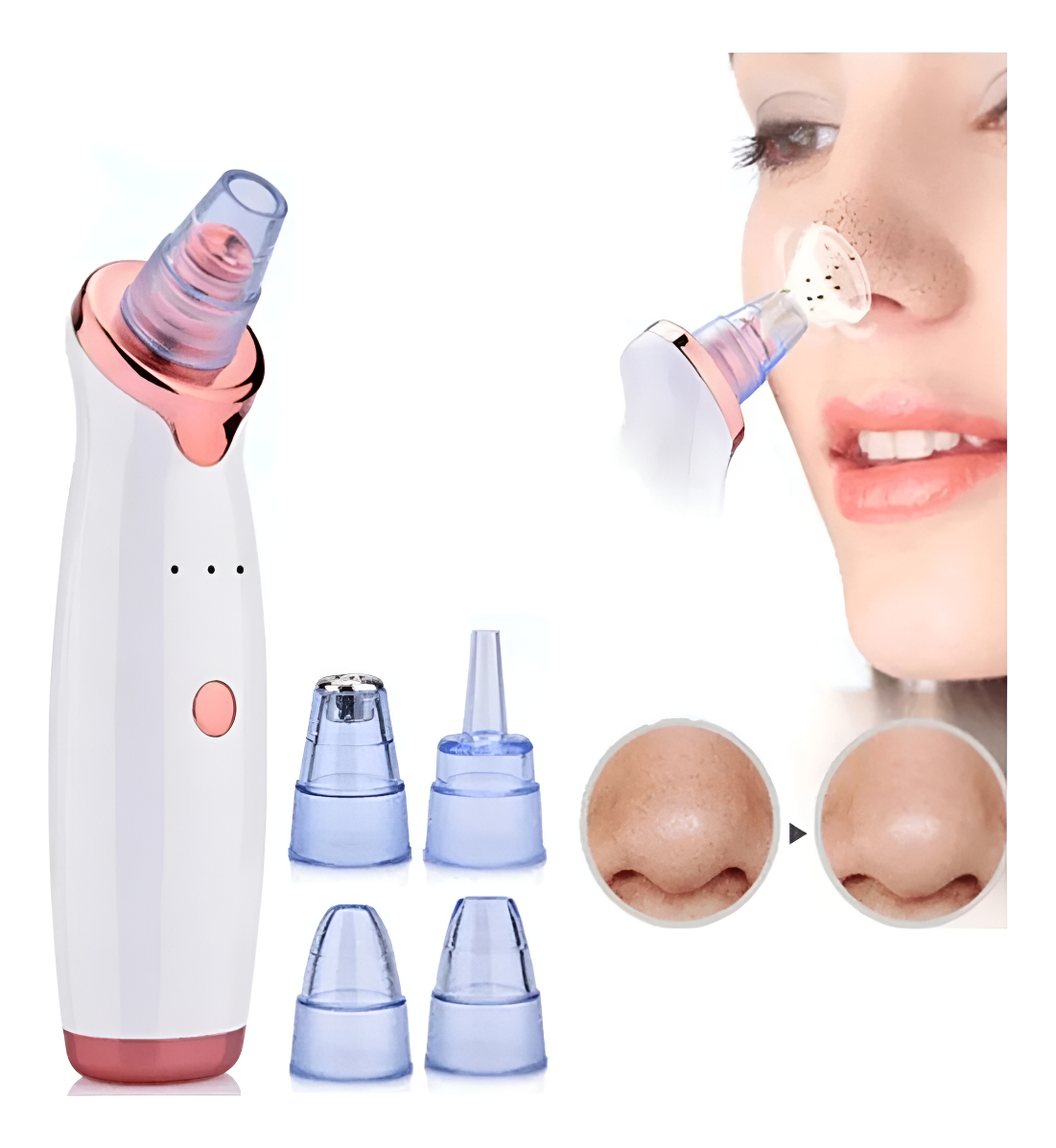Top 10 Melhores Removedores de Cravos  (DermaSuction, Voyor e mais) 2
