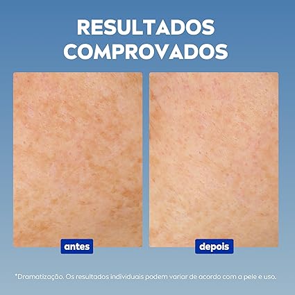 Luminous 630 Antimarcas Sérum Anti-idade 3
