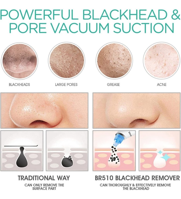 VOYOR Blackhead Vacuum Removal Tool 3