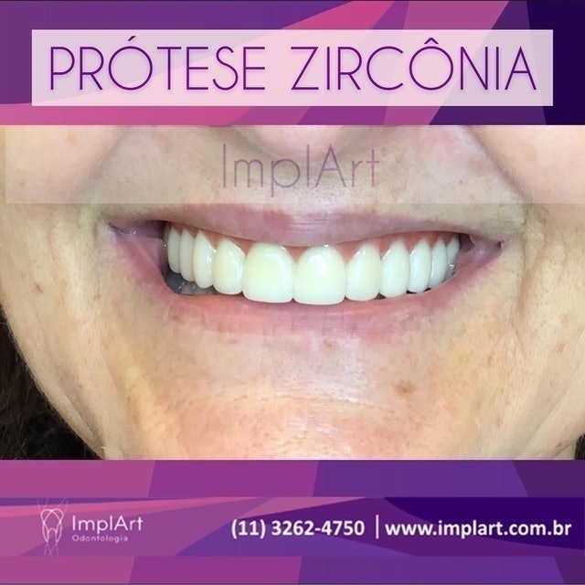 ImplArt Odontologia 2