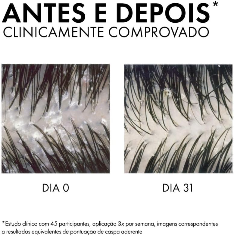 Shampoo Dermatológico Dercos Anticaspa DS 2