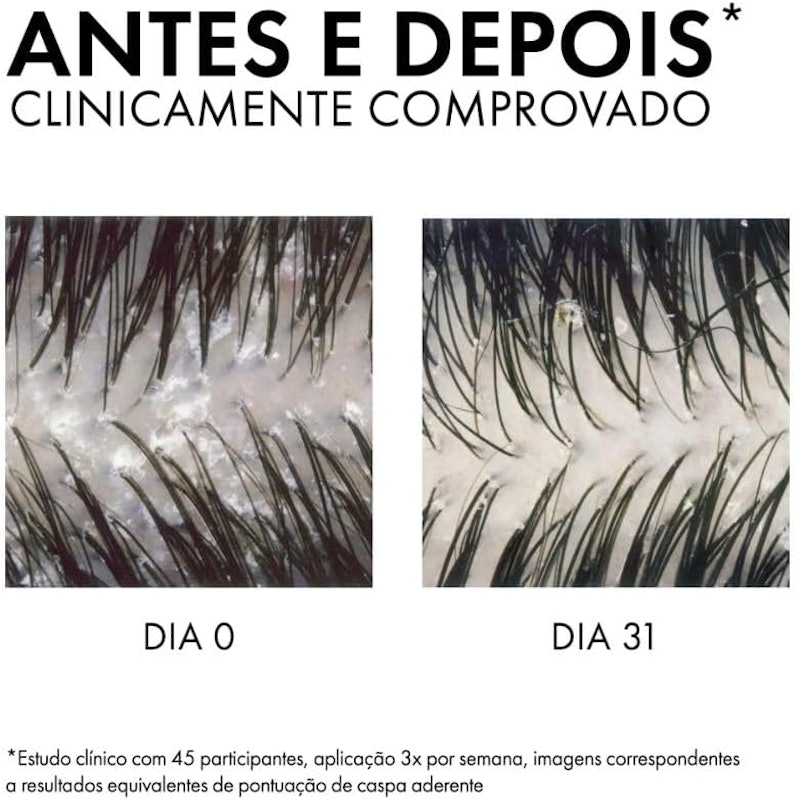 Shampoo Dermatológico Dercos Anticaspa DS 2