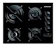 BRASTEMP Cooktop 4 Bocas Brastemp com Duplachama e Timer Touch 1