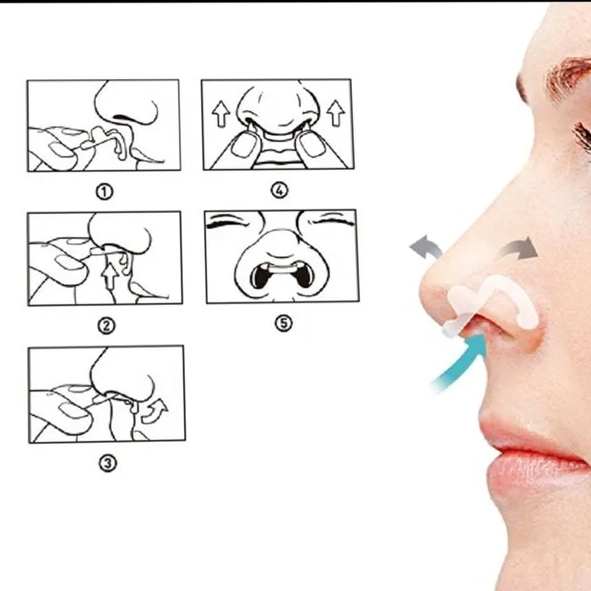 Flux Air Dilatador Nasal Interno 4